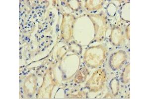 Immunohistochemistry of paraffin-embedded human kidney tissue using ABIN7168739 at dilution of 1:100 (PLA2R1 antibody  (AA 395-530))