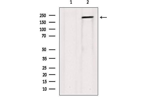 COL5A1 antibody  (Internal Region)