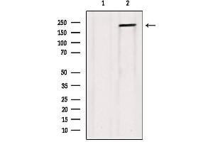 Western blot analysis of extracts from Hela, using Collagen V α1 Antibody.