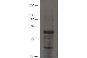 Image no. 1 for anti-Ajuba LIM Protein (AJUBA) antibody (ABIN1169674) (AJUBA antibody)