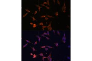 Immunofluorescence analysis of NIH-3T3 cells using UMPS Polyclonal Antibody (ABIN6128901, ABIN6149927, ABIN6149929 and ABIN6217183) at dilution of 1:100 (40x lens). (UMPS antibody  (AA 100-260))