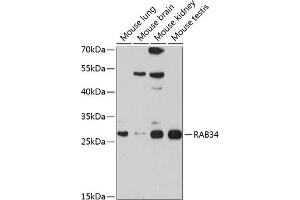 Western blot analysis of extracts of various cell lines, using R antibody (ABIN6133004, ABIN6146574, ABIN6146575 and ABIN6214549) at 1:1000 dilution. (RAB34 antibody  (AA 1-259))
