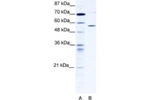 Western Blotting (WB) image for anti-Chaperonin Containing TCP1, Subunit 4 (Delta) (CCT4) antibody (ABIN2460902) (CCT4 antibody)