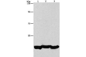 Western Blot analysis of A549 cell and Mouse liver tissue, hepG2 cell using PGK1 Polyclonal Antibody at dilution of 1:1000 (PGK1 antibody)