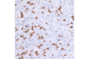 Immunohistochemistry (IHC) image for anti-CD3 epsilon (CD3E) (AA 157-207) antibody (ABIN7454035) (Recombinant CD3 epsilon antibody  (AA 157-207))