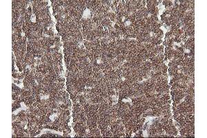 Image no. 1 for anti-Differentially Expressed in FDCP 6 Homolog (DEF6) antibody (ABIN1497808) (DEF6 antibody)