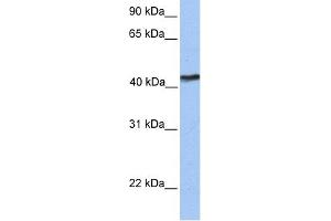 WB Suggested Anti-TMEM149 Antibody Titration:  0. (IGF-like family receptor 1 (IGFLR1) (N-Term) antibody)