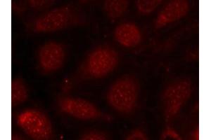 Immunofluorescence staining of methanol-fixed MCF7 cells using PKCb(phospho-Thr641) antibody. (PKC beta antibody  (pThr641))