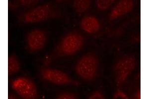 Immunofluorescence staining of methanol-fixed MCF7 cells using PKCb(phospho-Thr641) antibody. (PKC beta antibody  (pThr641))