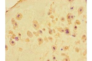 Immunohistochemistry of paraffin-embedded human placenta tissue using ABIN7159183 at dilution of 1:100 (RIKEN cDNA 4930404A10 Gene (4930404A10RIK) (AA 18-91) antibody)