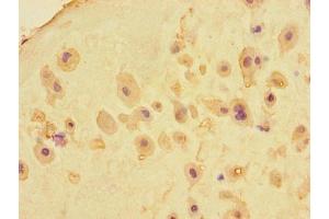 Immunohistochemistry of paraffin-embedded human placenta tissue using ABIN7159183 at dilution of 1:100