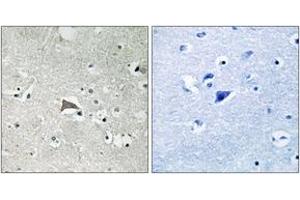 Immunohistochemistry analysis of paraffin-embedded human brain tissue, using VEGFR1 (Ab-1048) Antibody.