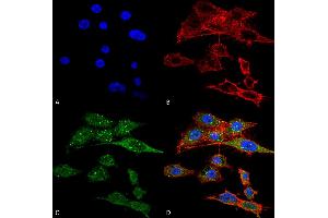 Immunocytochemistry/Immunofluorescence analysis using Rabbit Anti-Rubicon Polyclonal Antibody . (Rubicon antibody  (N-Term) (PE))