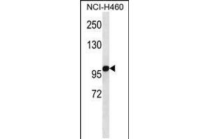 Western blot analysis in NCI-H460 cell line lysates (35ug/lane). (alpha KGDHC antibody  (C-Term))