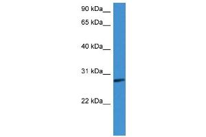 Western Blotting (WB) image for anti-Complement Factor D (CFD) (C-Term) antibody (ABIN2788362) (Adipsin antibody  (C-Term))