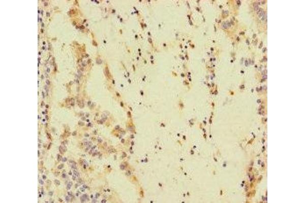 SPEM1 antibody  (AA 50-309)