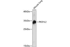 Western blot analysis of extracts of mouse lung, using PKD1L2 antibody (ABIN7269451) at 1:1000 dilution. (PKD1L2 antibody  (AA 1-306))