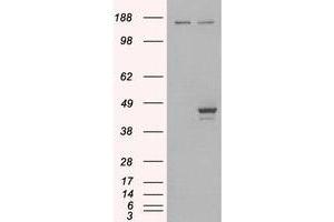 Image no. 2 for anti-E74-Like Factor 3 (Ets Domain Transcription Factor, Epithelial-Specific) (ELF3) (C-Term) antibody (ABIN374234) (ELF3 antibody  (C-Term))