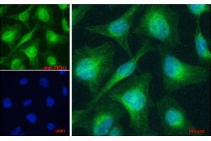 ABIN1590007 Immunofluorescence analysis of paraformaldehyde fixed HeLa cells, permeabilized with 0. (Patched 1 antibody  (AA 266-280))