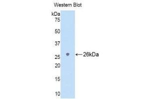 Western Blotting (WB) image for anti-Lymphocyte Antigen 9 (CD229) (AA 2-212) antibody (ABIN1174910) (LY9 antibody  (AA 2-212))