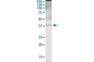 FBP1 MaxPab rabbit polyclonal antibody. (FBP1 antibody  (AA 1-338))