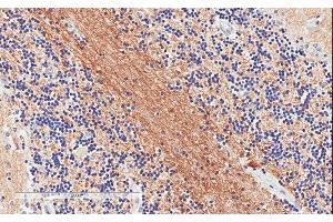 ABIN185392 (1µg/ml) staining of paraffin embedded Human Cerebellum. (SNAP25 antibody  (C-Term))