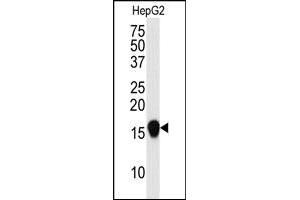 Image no. 2 for anti-Small Ubiquitin Related Modifier 4 (SUMO4) (Met55Val-Mutant) antibody (ABIN356787) (SUMO4 antibody  (Met55Val-Mutant))