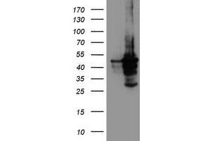 HEK293T cells were transfected with the pCMV6-ENTRY control (Left lane) or pCMV6-ENTRY CYP2A6 (Right lane) cDNA for 48 hrs and lysed. (CYP2A6 antibody)