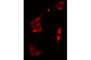 ABIN6274917 staining Hela cells by IF/ICC. (BST2 antibody  (Internal Region))