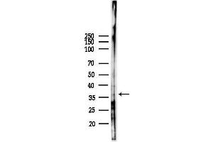 anti-MAS-Related GPR, Member X1 (MRGPRX1) (C-Term) antibody
