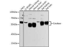 Western blot analysis of extracts of various cell lines, using Catalasealase Antibody (ABIN6133450, ABIN6137987, ABIN6137989 and ABIN6215464) at 1:3000 dilution. (Catalase antibody  (AA 1-225))