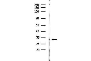 anti-Tumor Necrosis Factor Receptor Superfamily, Member 10b (TNFRSF10B) (N-Term) antibody