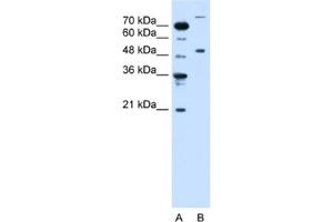 Western Blotting (WB) image for anti-Tripartite Motif Containing 42 (TRIM42) antibody (ABIN2462695) (TRIM42 antibody)