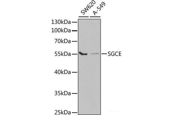SGCE anticorps