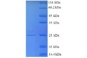 SDS-PAGE (SDS) image for Selenoprotein T (SELT) (AA 20-195) protein (His tag) (ABIN4974920) (SELT Protein (AA 20-195) (His tag))