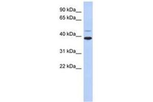 Image no. 1 for anti-Ring Finger Protein 121 (RNF121) (AA 215-264) antibody (ABIN6743182) (RNF121 antibody  (AA 215-264))