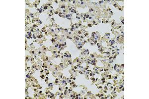 Immunohistochemistry of paraffin-embedded mouse lung using POT1 antibody (ABIN5970699) at dilution of 1/100 (40x lens).