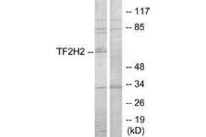 Western Blotting (WB) image for anti-General Transcription Factor IIH, Polypeptide 2, 44kDa (GTF2H2) (AA 1-50) antibody (ABIN2889585) (GTF2H2 antibody  (AA 1-50))