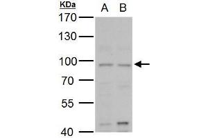 WB Image MLH1 antibody detects MLH1 protein by western blot analysis. (MLH1 antibody)