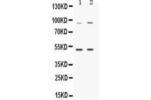 Western blot analysis of MAP3K8 expression in rat brain extract ( Lane 1) and HELA whole cell lysates ( Lane 2). (MAP3K8 antibody  (AA 9-193))