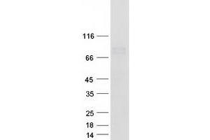 Western Blotting (WB) image for Mannan-Binding Lectin Serine Peptidase 1 (MASP1) (Transcript Variant 1) protein (Myc-DYKDDDDK Tag) (ABIN2725532)