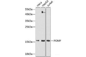 Western blot analysis of extracts of various cell lines using POMP Polyclonal Antibody at dilution of 1:3000. (POMP antibody)