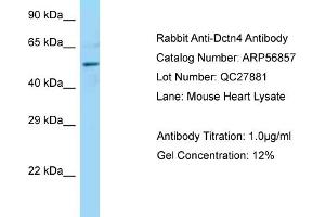 Western Blotting (WB) image for anti-Dynactin 4 (DCTN4) (C-Term) antibody (ABIN2786941) (Dynactin 4 antibody  (C-Term))