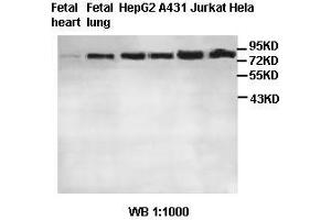Image no. 2 for anti-MRE11 Meiotic Recombination 11 Homolog A (S. Cerevisiae) (MRE11A) antibody (ABIN791214)