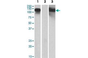 HEK293 lysate (10 ug protein in RIPA buffer) overexpressing human CDH11 with C-terminal MYC tag probed with CDH11 polyclonal antibody  (1 ug/mL) in Lane 1 and probed with anti-MYC Tag (1/1000) in Lane 3. (OB Cadherin antibody  (AA 497-509))