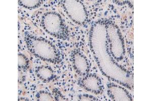 Used in DAB staining on fromalin fixed paraffin- embedded stomach tissue (SHBG antibody  (AA 51-218))