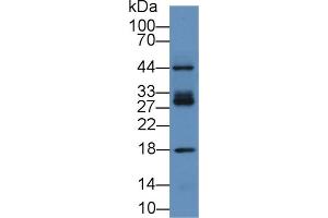Detection of ICAM2 in Human Hela cell lysate using Polyclonal Antibody to Intercellular Adhesion Molecule 2 (ICAM2) (ICAM2 antibody  (AA 27-248))