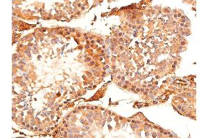 Immunohistochemistry (IHC) image for anti-Checkpoint Kinase 1 (CHEK1) (pSer296) antibody (ABIN6256251)