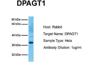 Host: Rabbit Target Name: DPAGT1 Sample Tissue: Human Hela Antibody Dilution: 1. (DPAGT1 antibody  (C-Term))