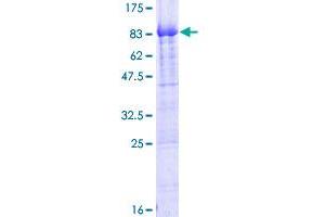 PIKFYVE Protein (AA 1-451) (GST tag)